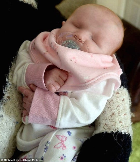 Bé Daisy bất hạnh từ khi chào đời. Ảnh: Daily Mail