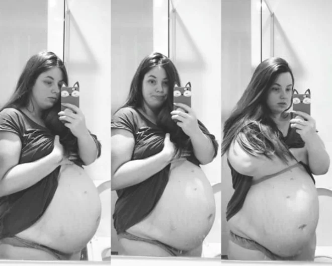 Bụng của Chloe Dunstan bắt đầu to lên. Bác sĩ cho biết cô mang thai 2 bé trai và một bé gái. Tuy nhiên bé gái không phát triển nhiều do bị thiếu oxy và dưỡng chất. Ở tuần 28 thai kỳ, người mẹ phải đối mặt với một quyết định vô cùng khó khăn là bỏ một thai tự nhiên để 2 bé còn lại phát triển hoặc sinh non để cứu cả ba bé.