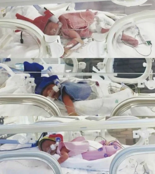Sinh non là điều không ai mong muốn nhưng người mẹ quyết định chọn giải pháp này để cứu cả 3 con. Ca sinh diễn ra bằng phương pháp mổ. Chloe và chồng, anh Rohan hạnh phúc chào đón 3 con Henry, Rufus và Pearl ra đời.