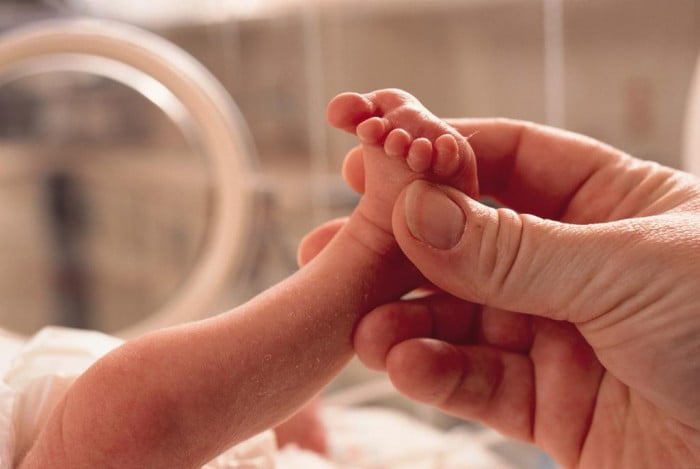 Sinh non là nguyên nhân tử vong hàng đầu ở trẻ sơ sinh