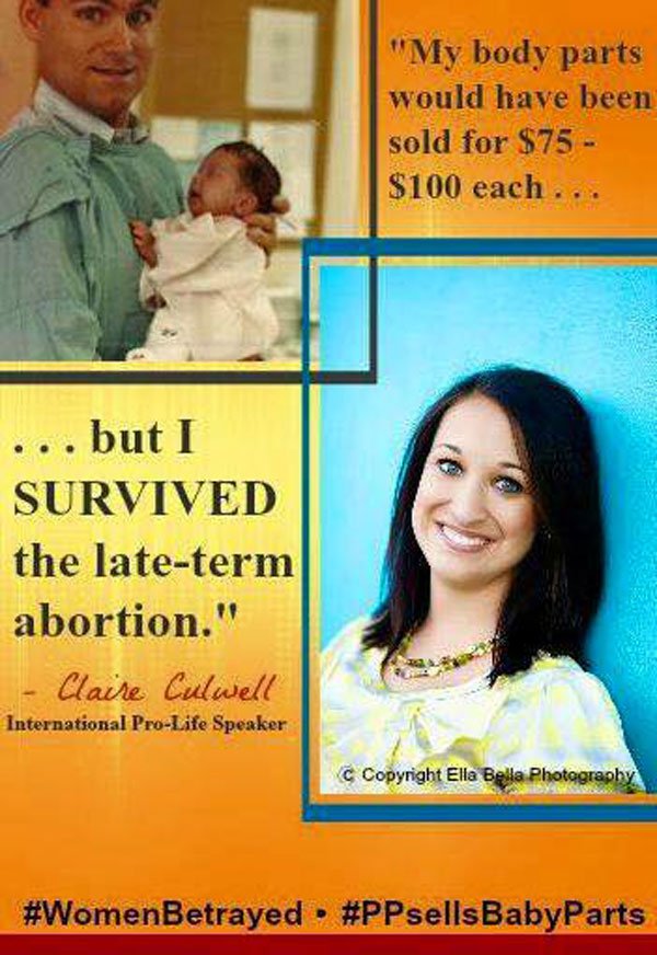 Claire trong một chiến dịch phản đối việc nạo phá thai