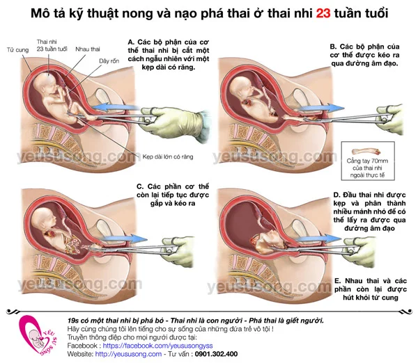 pha-thai-23-tuan