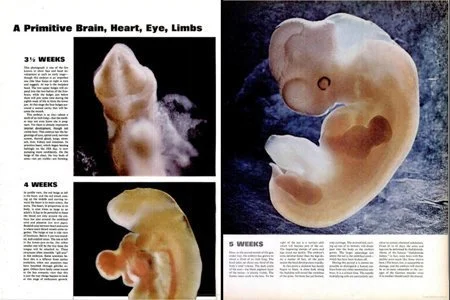  Tim, não, mắt và các chi bắt đầu được hình thành khi phôi thai được 3,5-5 tuần tuổi. 