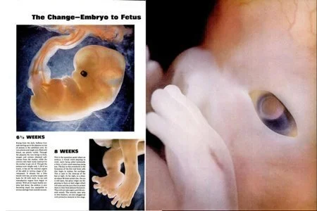  Quá trình chuyển từ phôi thai thành bào thai từ 6,5 tới 8 tuần. 